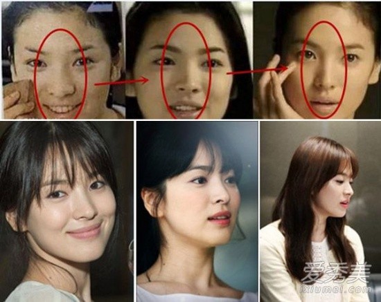 Song Hye Kyo đẹp đến độ hoàn hảo. Ở tuổi 35, cô ngọt ngào và trẻ trung như mới 20. Nhưng thực tế, kiều nữ mặt mộc luôn phải đối diện với nghi án nâng mũi. Từ khuôn mũi to, hơi cong, giờ cô đã có chóp mũi cao và thon gọn.