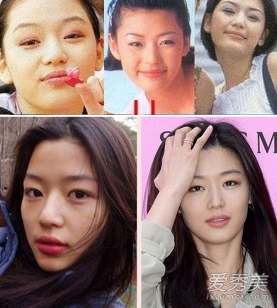 Jeon Ji Hyun với loạt ảnh bằng chứng đã từng chỉnh sửa mắt và mũi. Đặc biệt là vùng mí mắt trên, cô từng bị sưng húp nhưng giờ lại hoàn toàn không có tì vết.