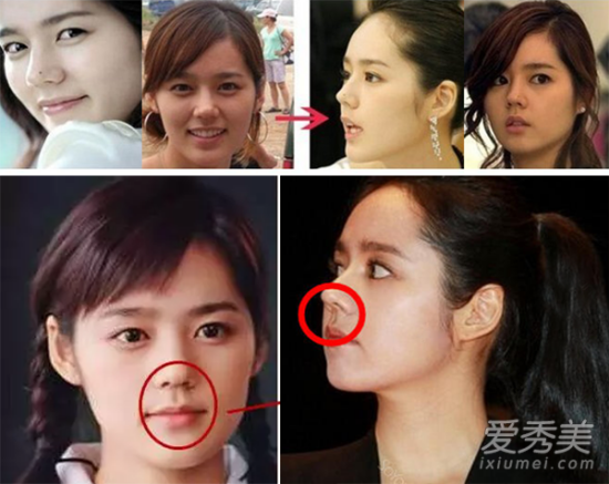 Han Ga In nổi bật vì vùng mũi hoàn hảo. Nhưng bức ảnh so sánh cho thấy, mũi của cô chắc hẳn đã từng đụng dao kéo.