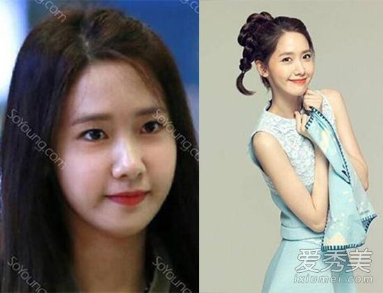 Yoona với bức ảnh so sánh đặt nghi vấn cô gọt mặt và chỉnh mắt.