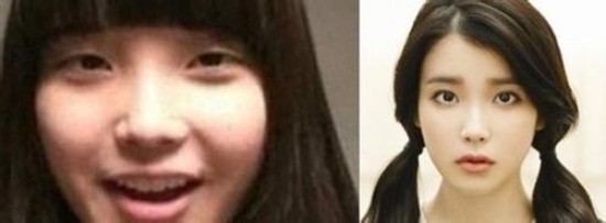 Ảnh ngày ấy và bây giờ. Nhiều khả năng kiều nữ Hàn đã xử lý vùng mắt, mũi và miệng.