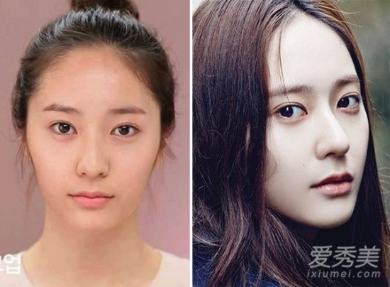 Nhưng không chỉ thế, Krystal còn bị nghi vấn đã từng chỉnh mí, thẩm mỹ khiến khuôn mí trở nên to và tự nhiên hơn.