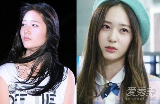 Krystal vướng nghi vấn chỉnh mũi với vùng mũi nhỏ và thon hơn.