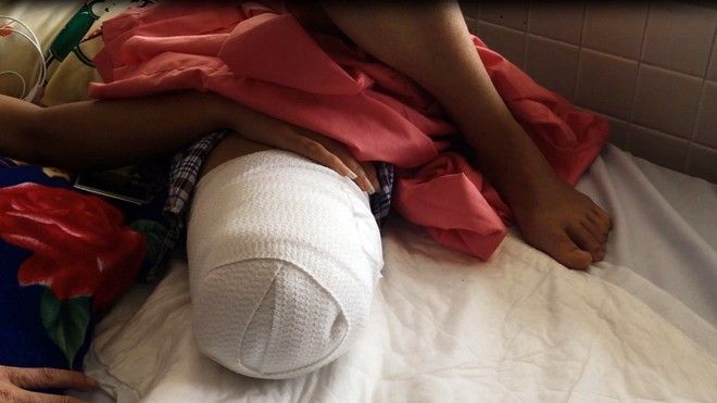 Dù chân Hà Vi xuất hiện nhiều triệu chứng bất thường nhưng bệnh viện Cư Kuin vẫn không cho chuyển viện để điều trị kịp thời.