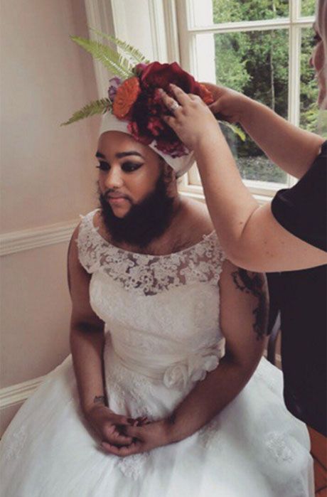 Giờ đây, Harnaam Kaaur đã bắt đầu đón bắt cơ hội trở thành người mẫu khi giới thời trang đang có xu hướng đa dạng hóa và chấp nhận mọi sự dị biệt để khiến sàn catwalk trở nên “kịch tính” hơn.