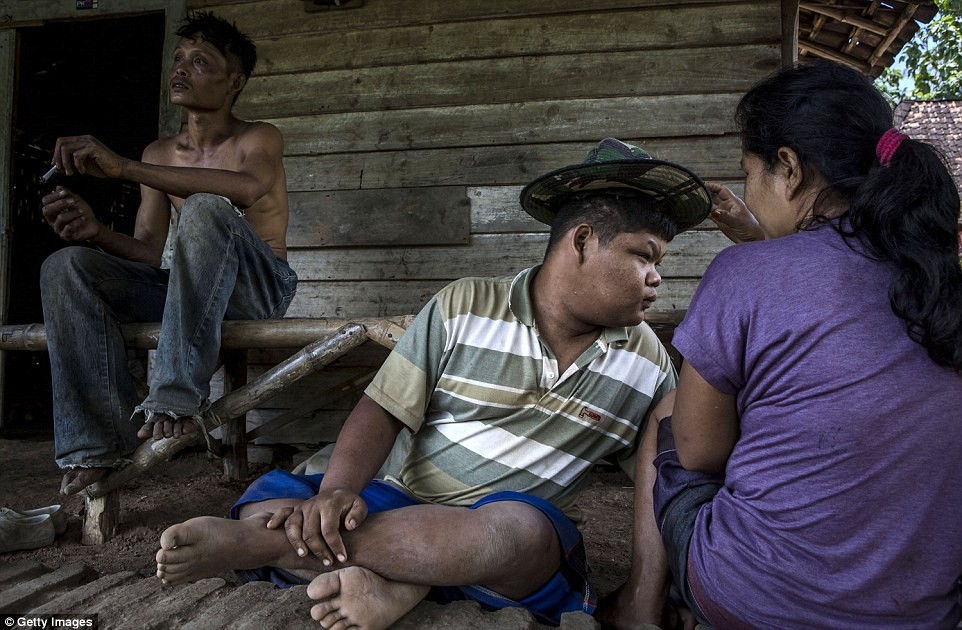  Andika, 17 tuổi mắc chứng Down