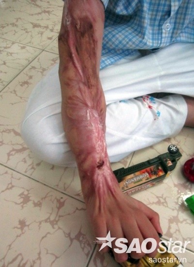 tat a xit quan go vap