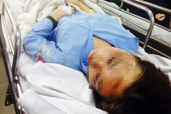 nu-sinh-bi-tat-axit-3