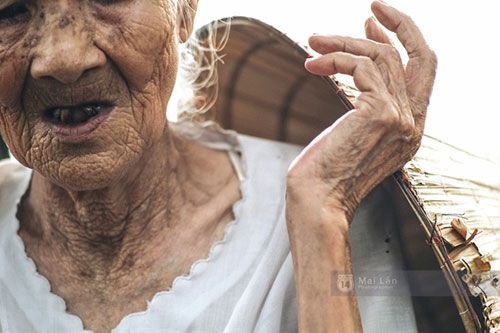 Hai hàm răng đã gãy rụng nhiều.