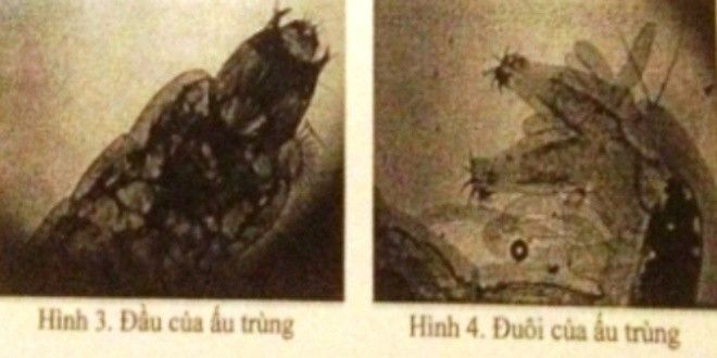 Kết quả nghiên cứu của Viện sốt rét - ký sinh trùng - côn trùng Trung ương, sinh vật lạ là ấu trùng ruồi cống. Ảnh: Tư liệu. 