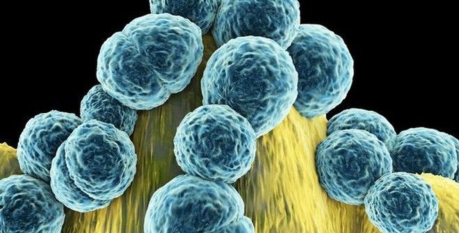 2-khi-khang-sinh-tro-nen-vo-dung-so-nguoi-chet-vi-vi-khuan-se-con-nhieu-hon-nan-nhan-ung-thu-1461037321734-53-0-366-615-crop-1461037561064