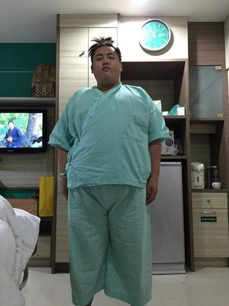 Anh chàng đã chọn cách phẫu thuật thắt dạ dày để giảm cân nhanh nhất