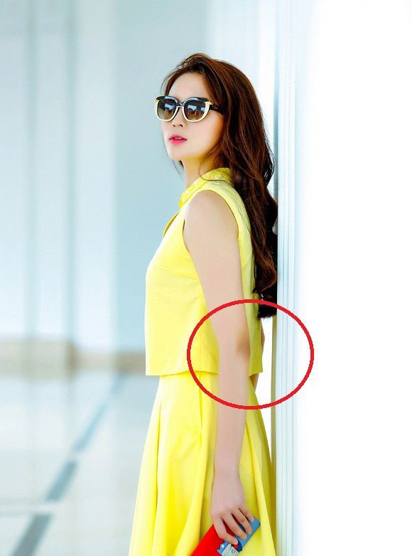 Cả người Kỳ Duyên trắng nõn nà, mịn mà nhưng chỉ có ở khuỷu tay là đen đầy khó hiểu.