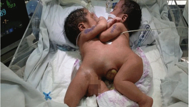 BT Tiến chỉ đạo gấp vụ 'PGĐ bệnh viện ra chợ xin tiền từ thiện' Ảnh 2