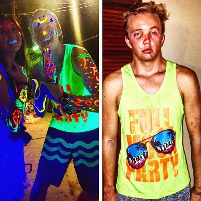 Tại một bữa tiệc trên đảo Koh Phangan, Thái Lan, Gleason đã bị đánh thuốc mê, bị cướp và bị đánh đập bởi một băng đảng địa phương. Cậu tỉnh dậy trong bệnh viện và mất hết hành lý lẫn giấy tờ. Sau đó, cậu phải sống nhờ vào lòng tốt của những người khách du lịch đến từ nước khác. Họ cũng là những người đã phát hiện ra cậu bị thương nặng và nằm bất tỉnh bên lề đường. Họ đã hô hấp nhân tạo và sơ cứu trước khi đưa cậu đến bệnh viện.