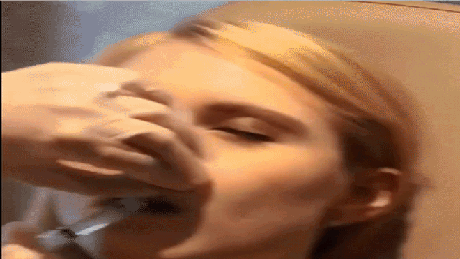 Nếu có ý định bơm môi, các cô gái phải xem ngay video này! Ảnh 2