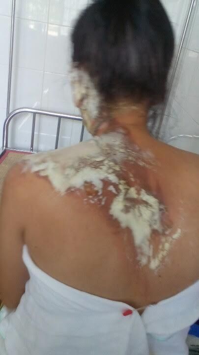 chong-de-vo-xuong-dat-roi-tuoi-nuoc-soi-vao-lo-tai-33-102339