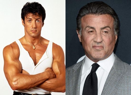 Giống như Mickey Rourke, Sylvester Stallone nằm trong số ít những nam nghệ sĩ không ngần ngại thừa nhận từng phẫu thuật thẩm mỹ.