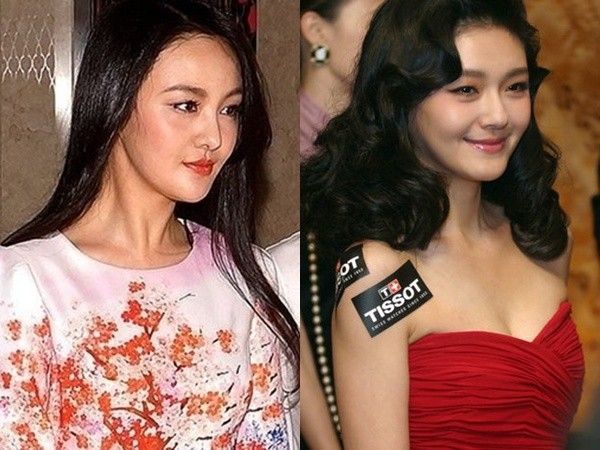 Người đẹp được ví như "bản sao" của Đại S sau khi dao kéo.