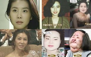 Ảnh 3. Cũng rất nhiều người bị ám ảnh bởi những hình ảnh phẫu thuật thẩm mỹ hỏng như thế này. 