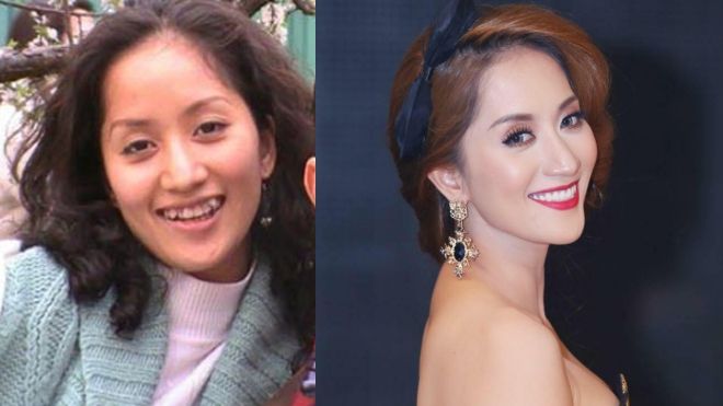 Ngày xưa ông cha ta vẫn thường nói “cái răng cái tóc răng, mái tóc là góc con người” quả thực không sai. Chỉ cần “trùng tu” hàm răng khấp khểnh ngày xưa đi là kiện tướng dancesport Khánh Thi đã trở nên khác rất nhiều. 