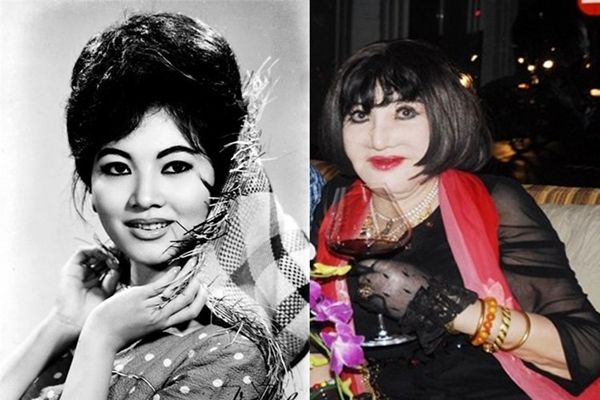 Thế nhưng, bà đã mắc phải sai lầm quá lớn khi lạm dụng phẫu thuật thẩm mỹ để níu kéo tuổi thanh xuân.