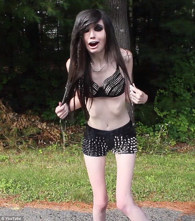 Cô bị cộng đồng mạng cáo buộc rằng đã khuyến khích chứng biếng ăn trong giới trẻ.