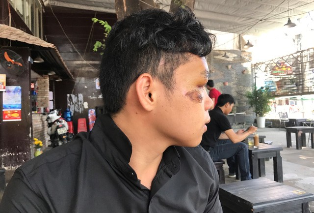 “Trong khoảnh khắc phút giây tăm tối nhất cuộc đời, bất chợt nhìn thấy những tia sáng leo lét, tôi bật ngồi dậy, đi vội như xác không hồn mà cứ ngỡ mình đã sang thế giới khác…”, anh Trần Công Tr., chia sẻ.