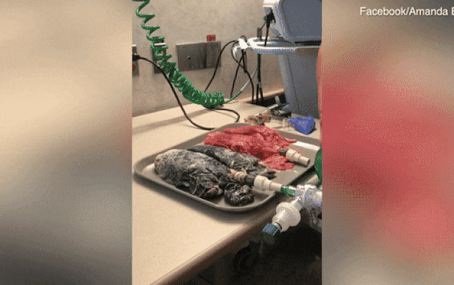 Sự khác biệt gây sốc giữa phổi của một người hút thuốc lá lâu năm và người khỏe mạnh Ảnh 2