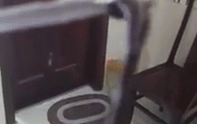 Gắp con đỉa dài 10cm còn sống ra khỏi mũi nữ bệnh nhân Ảnh 2