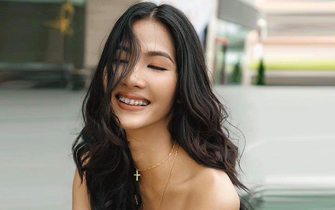 Bất chấp hàm răng mang đầy sắt, Hoàng Thùy, Khánh Linh, Ngô Trà My vẫn tự tin khoe nụ cười tỏa nắng! Ảnh 2