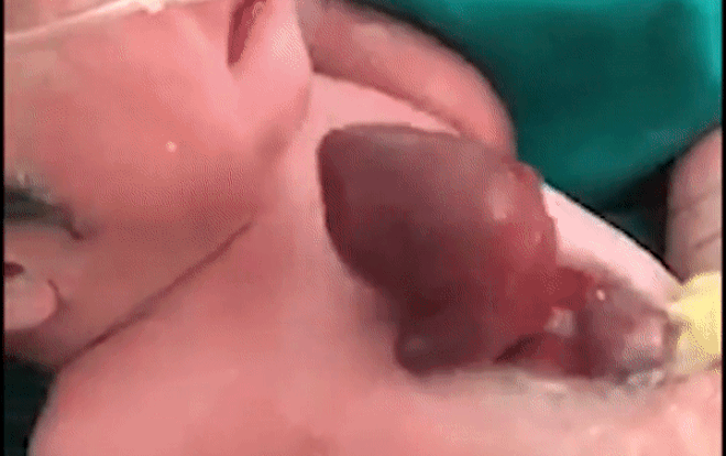 Khoảnh khắc trái tim ngoài lồng ngực của bé sơ sinh đập từng nhịp khiến người xem nín thở Ảnh 2