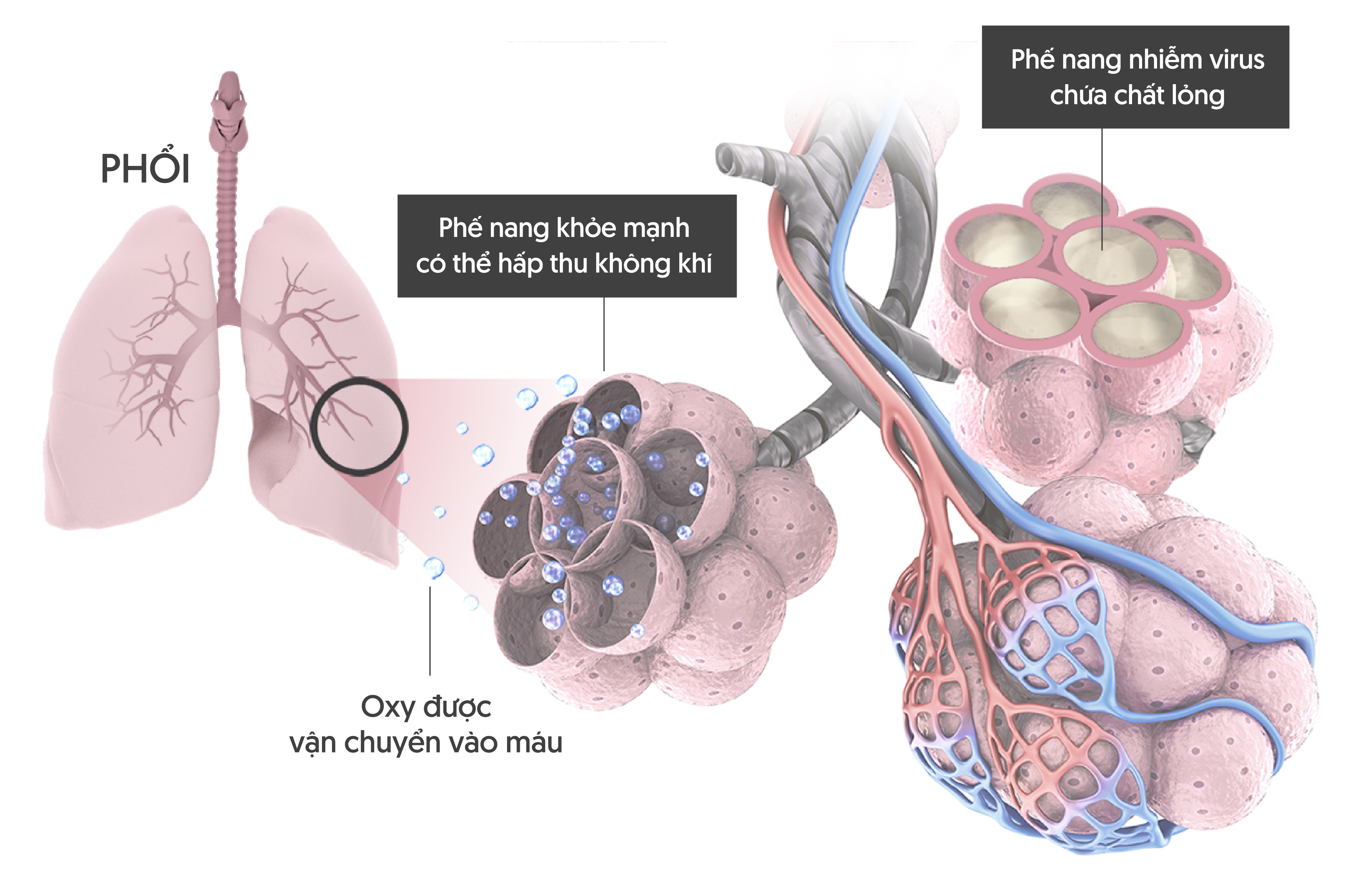 Máy thở hoạt động như thế nào với vai trò sống còn trong cuộc chiến chống COVID-19? Ảnh 3