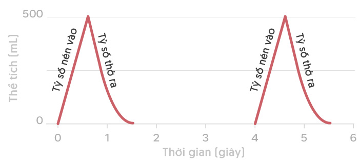 Máy thở hoạt động như thế nào với vai trò sống còn trong cuộc chiến chống COVID-19?