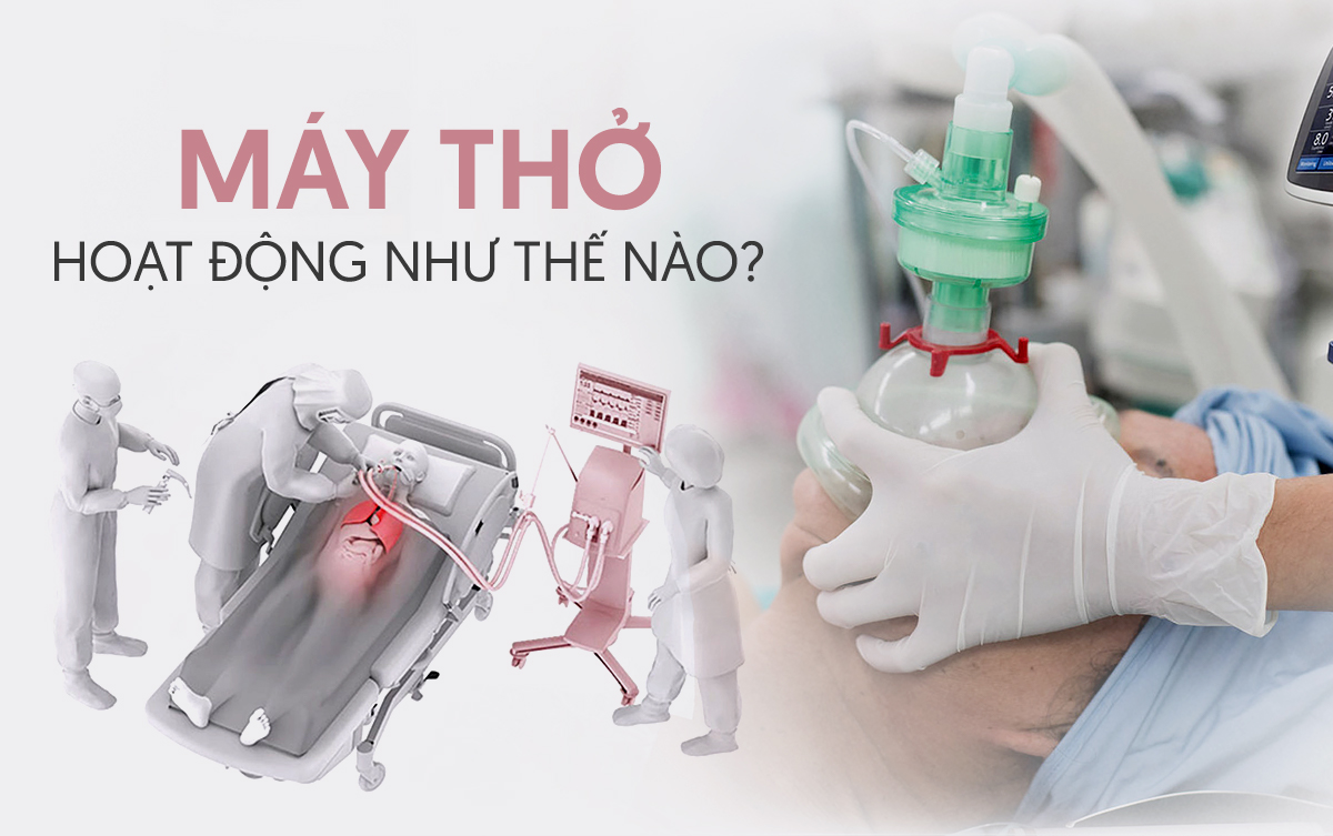 Máy thở hoạt động như thế nào với vai trò sống còn trong cuộc chiến chống COVID-19? Ảnh 2