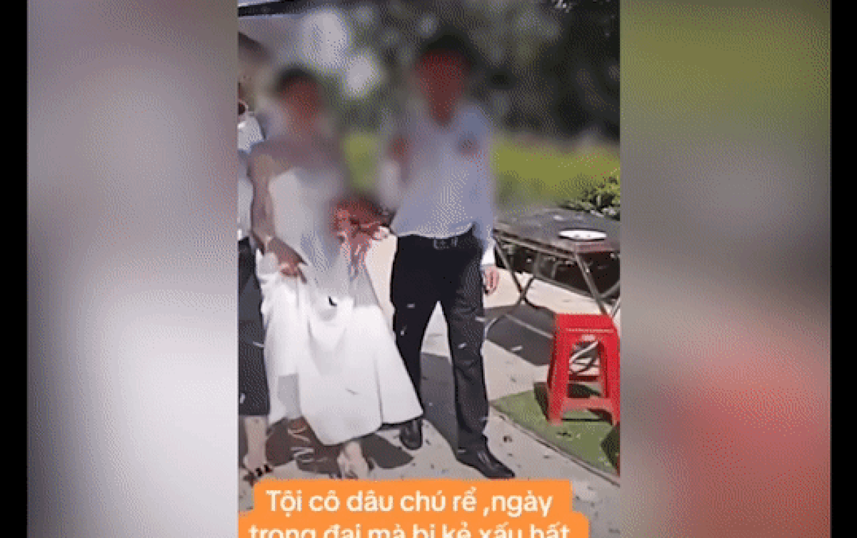 Diễn biến mới vụ cô dâu - chú rể bị tạt chất bẩn khi đang tiến vào sân khấu Ảnh 2