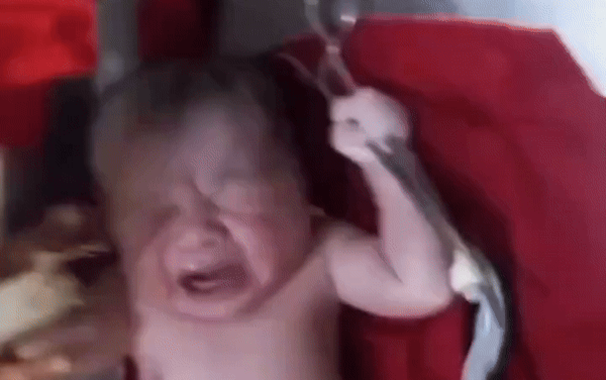 Đứa trẻ sơ sinh cầm chặt cây kéo khi vừa chào đời, khiến bác sĩ phải 'bó tay' Ảnh 2