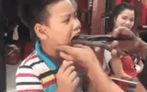 Dùng kìm tự nhổ răng cho con, ông bố hứng nguyên rổ 'gạch đá' từ phía cư dân mạng