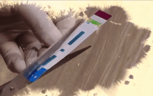 Đình chỉ 3 nhân viên bệnh viện Xanh Pôn trong vụ hàng nghìn que thử HIV, viêm gan B bị cắt trước khi làm xét nghiệm