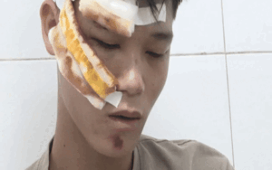 Clip: Lời khai tại bệnh viện của quái xế tông Đại uý gây chấn thương nặng