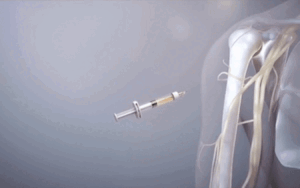 Clip: Tác dụng của vaccine AstraZeneca đối với cơ thể thế nào?