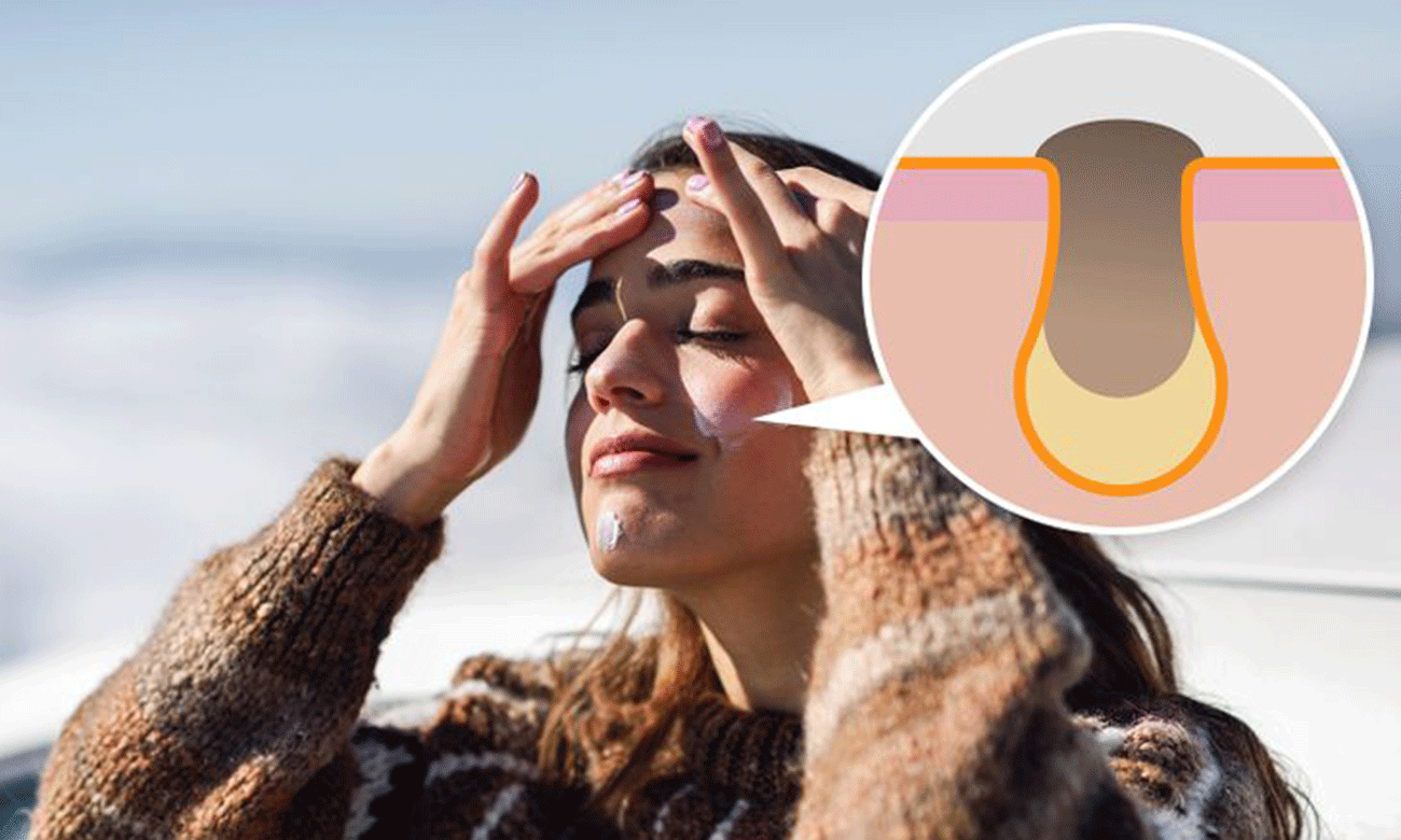 Nếu bạn mắc 7 sai lầm skincare này thì mụn tới cản không kịp Ảnh 2