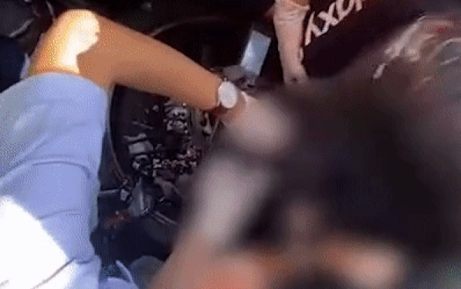 Clip: 'Nghẹt thở' giải cứu cô gái tay gãy gập, kẹt vào bánh xe máy do bị cuốn áo chống nắng Ảnh 2