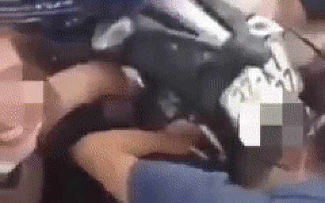 Người phụ nữ đau đớn vật vã, tay kẹt cứng cuốn vào bánh xe máy chỉ vì một vật dụng quen thuộc Ảnh 2