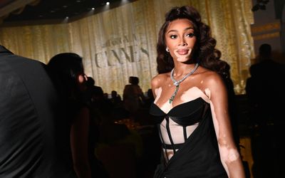 Winnie Harlow: siêu mẫu mắc bệnh bạch biến phá vỡ định kiến lỗi thời về tiêu chuẩn sắc đẹp