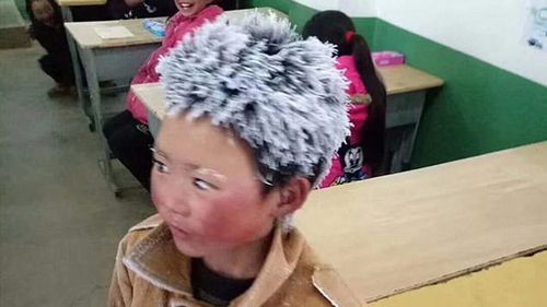 Cậu bé 'tóc đóng băng' được quyên góp 1 tỷ đồng nhưng chỉ nhận 28 triệu và lý do bất ngờ