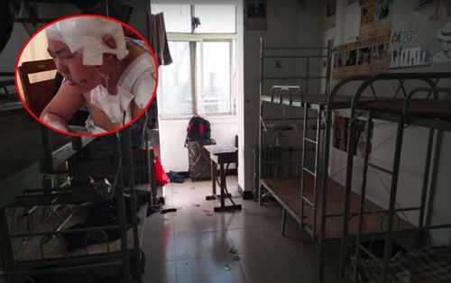Bị phàn nàn ngủ ngáy và xì hơi, nam sinh dùng dao đâm bạn cùng phòng thừa sống thiếu chết