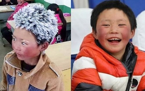 Cậu bé tóc đóng băng từng truyền cảm hứng tới lớp cho cả thế giới giờ ra sao sau 1 năm nổi đình đám trên MXH?