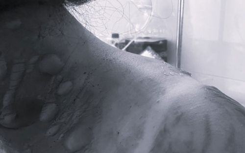 Đang nấu ăn, người phụ nữ phải nhập viện khẩn vì thứ phổ biến trong nhà bếp thường dùng