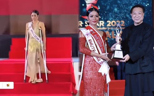 Một thí sinh hoa hậu cụt chân trình diễn váy dạ hội, thực hư ra sao?